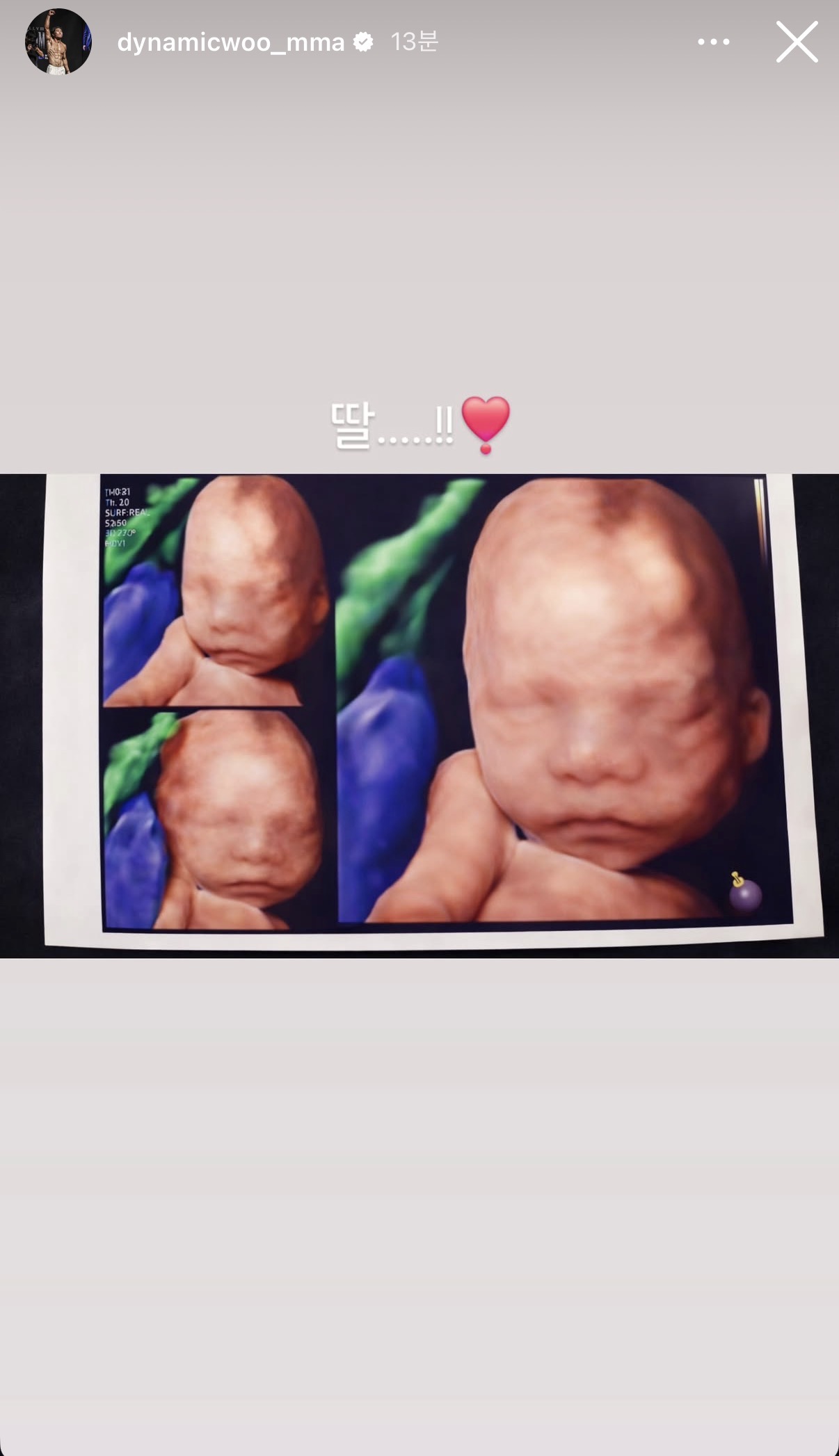 업로드된 이미지